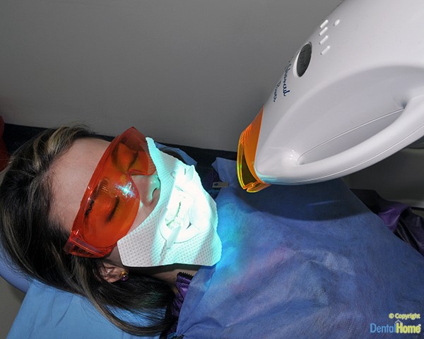 proceso-blanqueamiento-dental-medellin-zoom-advanced-power-600px