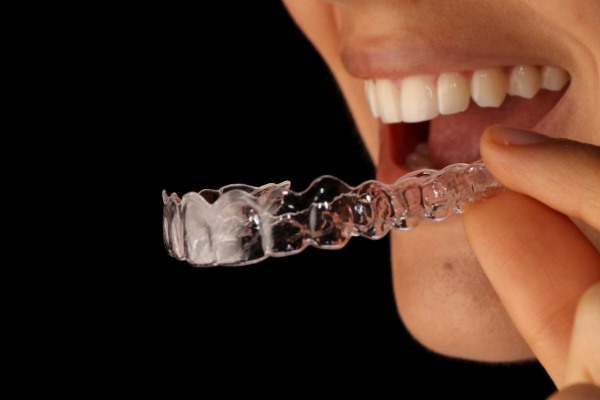 orthodontics with aligners transparent