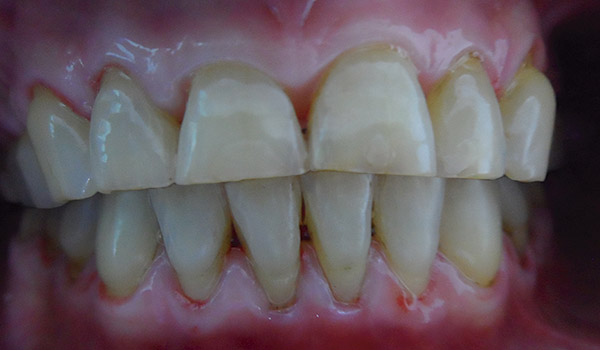 After-Higiene Oral
