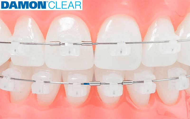 Clinica Dental Home Medell n Dise o De Sonrisa Clinica Dental Home Medell n Dise o De Sonrisa